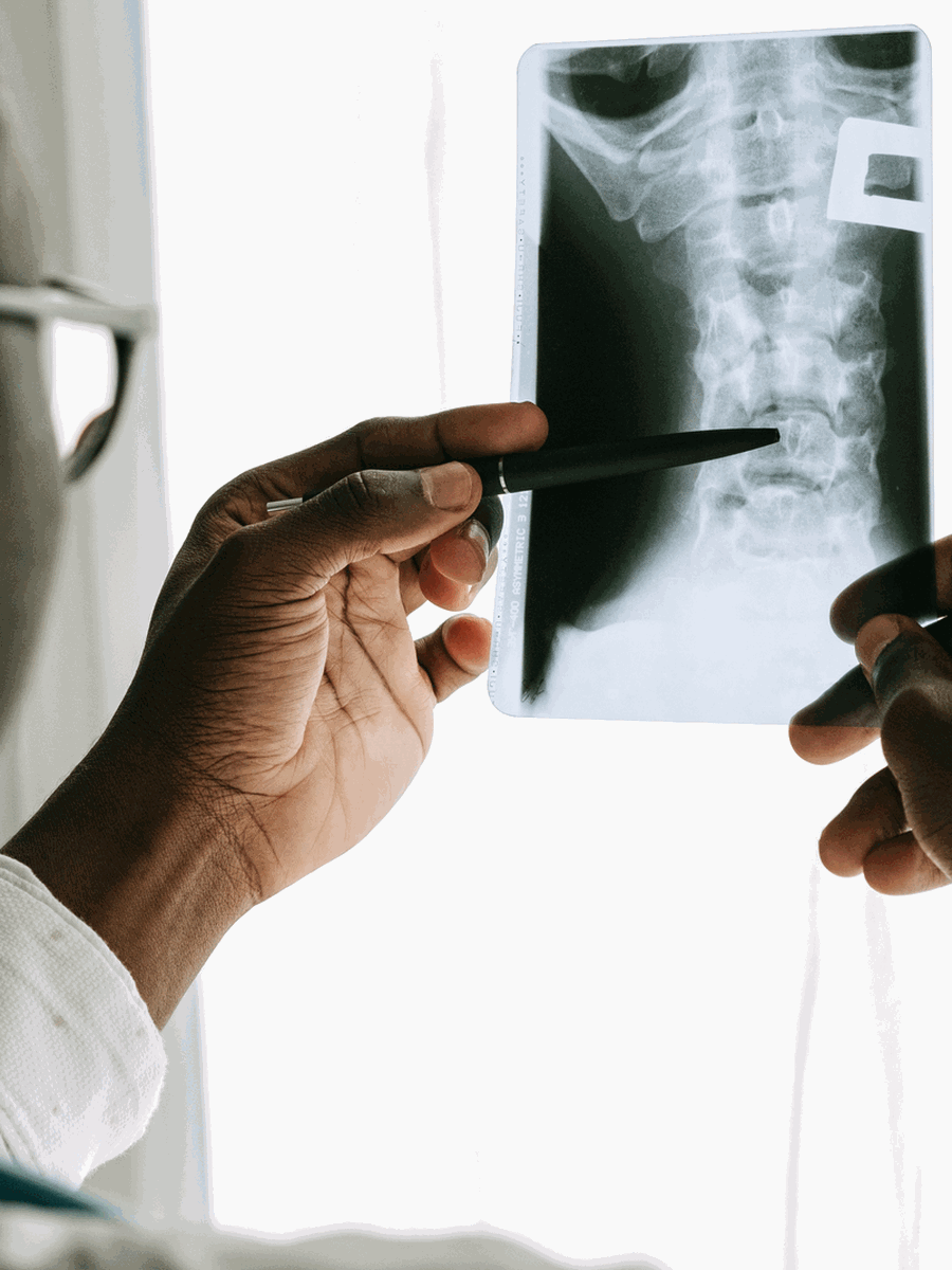 Fissure annulaire du disque : terminologie d’IRM, symptômes et traitement