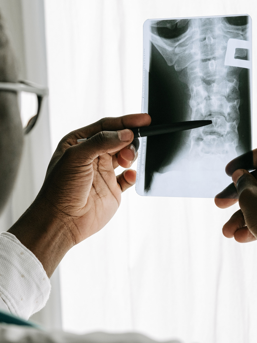 Hernie discale cervicale : douleur au bras, signes neurologiques et traitements