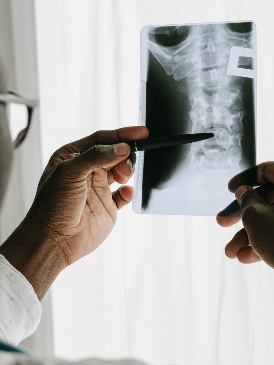 Cervical myelopathy: spinal-cord warning signs, diagnosis and treatment