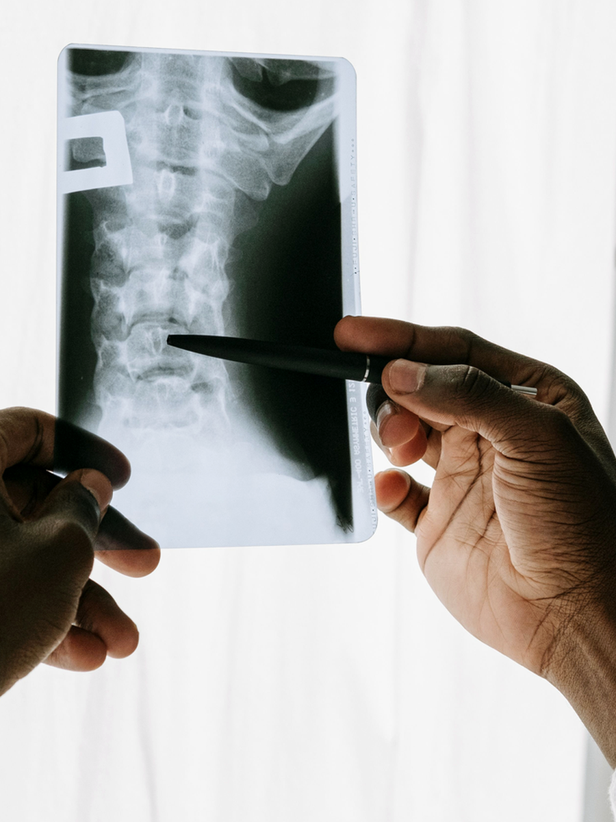 Cervical spinal stenosis: narrowing, nerve symptoms and treatment pathways