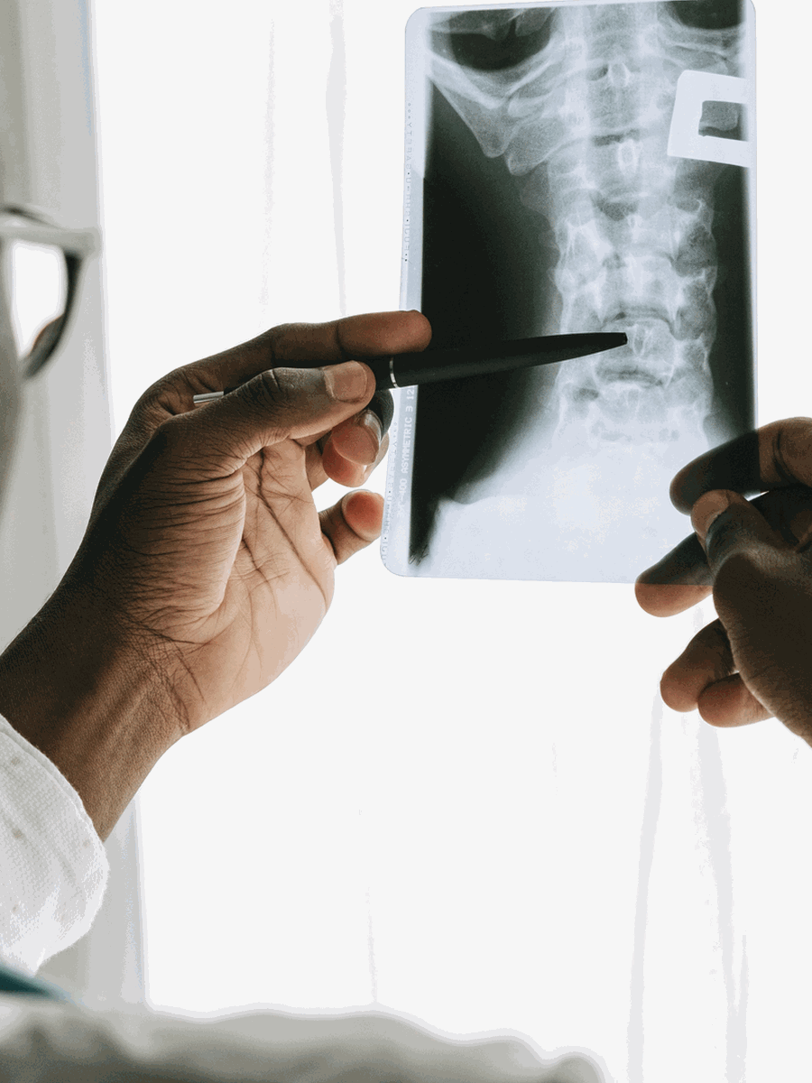 Endoscopic discectomy vs microdiscectomy: approaches, outcomes and selection