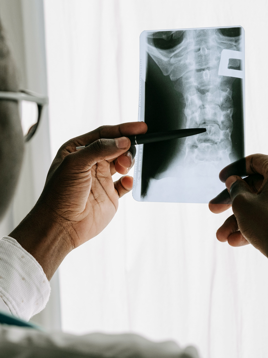 Epidural injections for sciatica: expected benefits, limits and safety