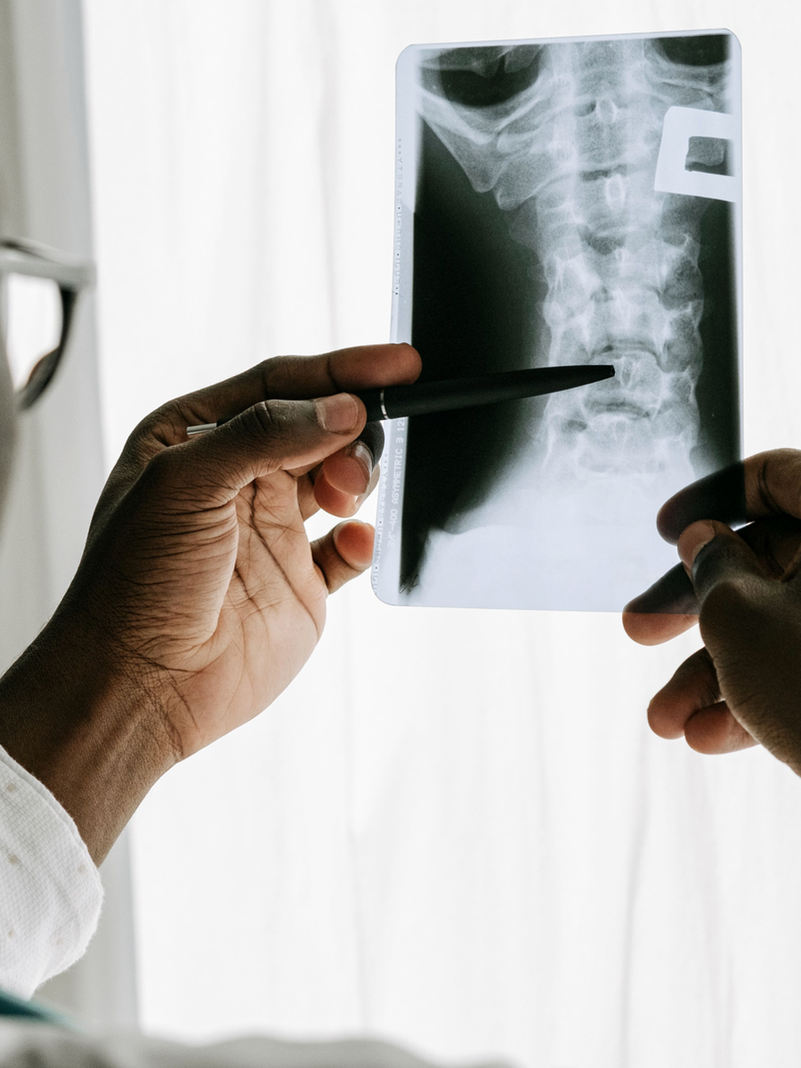 Exercise and rehabilitation for back pain: choosing and progressing a program