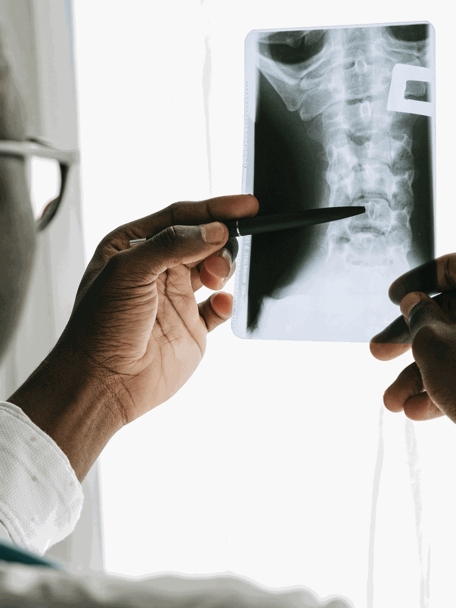 Herniated disc resorption and recovery time: what MRI changes mean