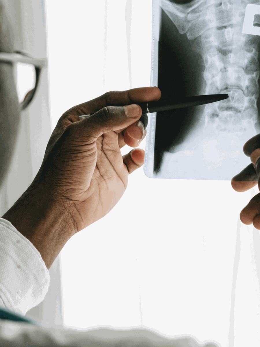 Scheuermann kyphosis vs postural kyphosis: rigid curve, imaging and treatment