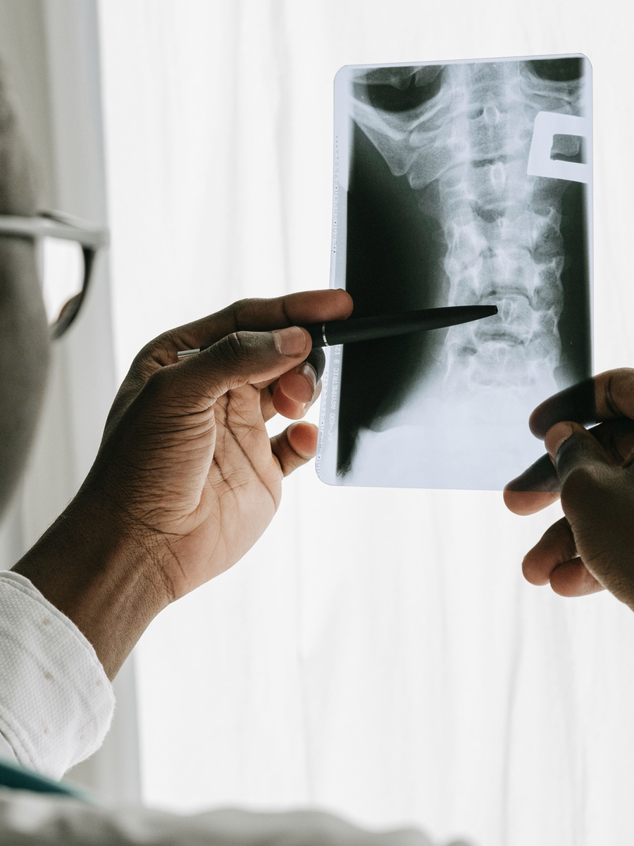 How many spinal decompression sessions are needed? Planning and reassessment