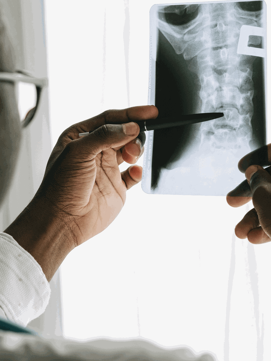 Lumbar vs cervical herniated disc: symptoms, risks and treatment differences