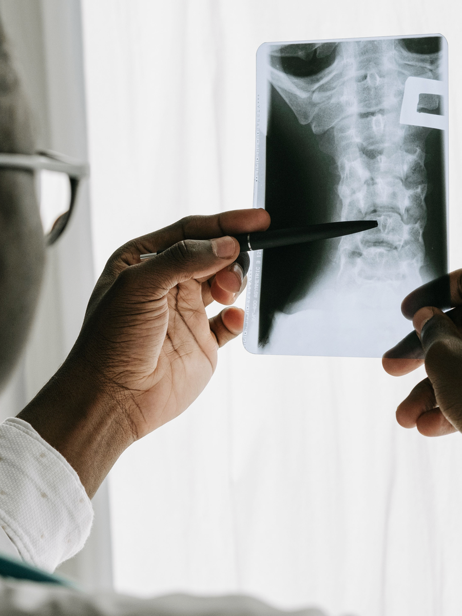 Manual therapy for back pain: role, limits and integration with exercise