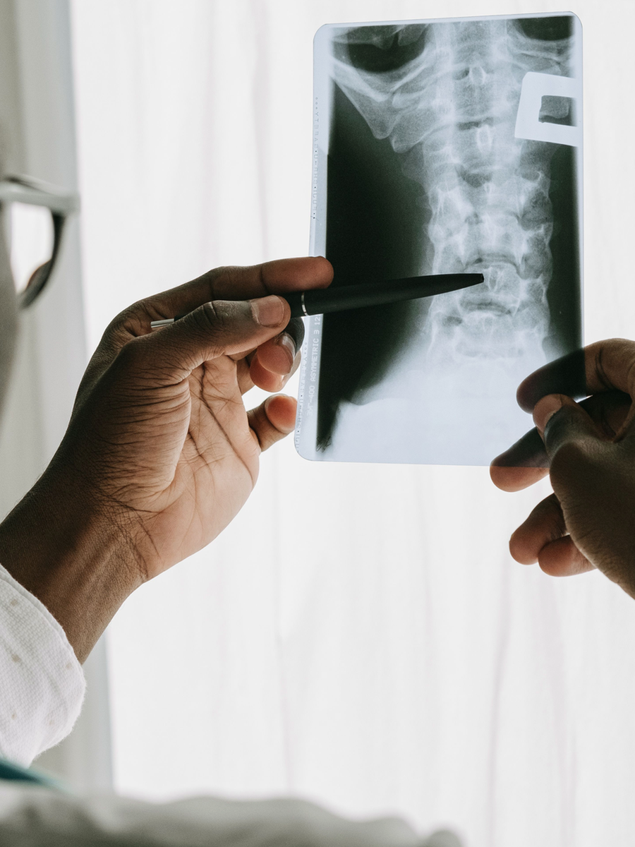 Medications for low back pain and sciatica: benefits, risks and guideline differences