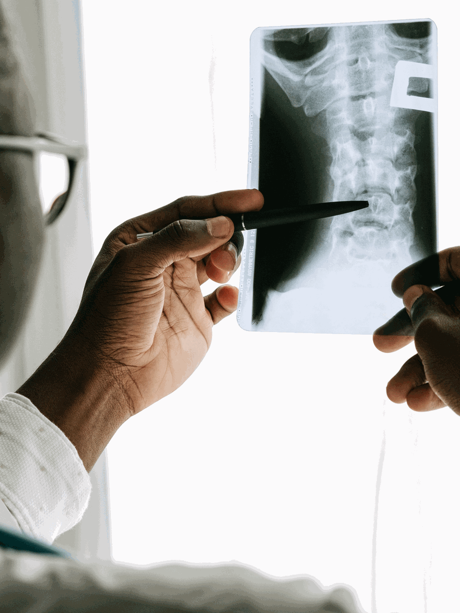 Disc protrusion, extrusion and sequestration: understanding MRI terminology