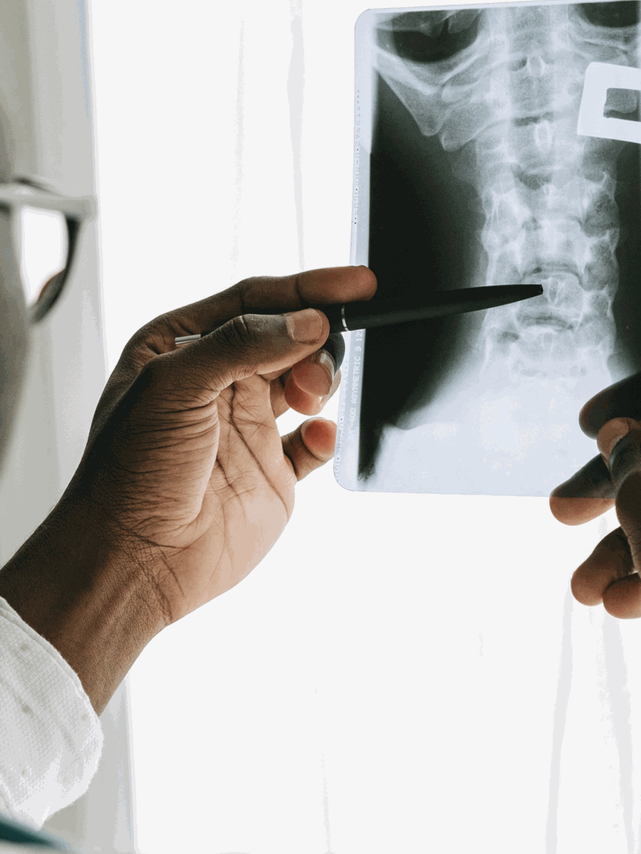 Sacroiliitis vs sacroiliac joint dysfunction: inflammatory or mechanical pain?