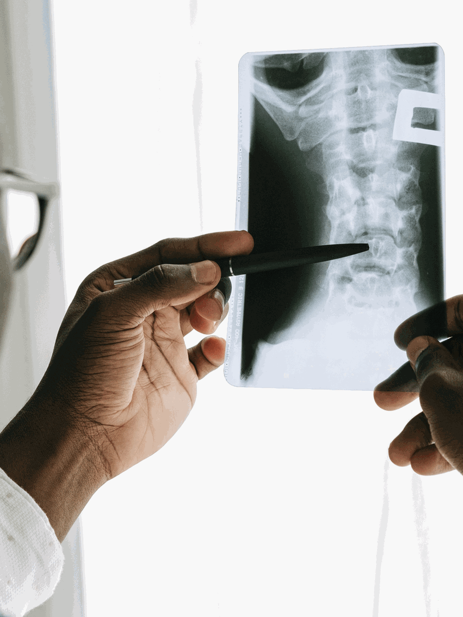 Return to sport after a herniated disc or sciatica: criteria and progression