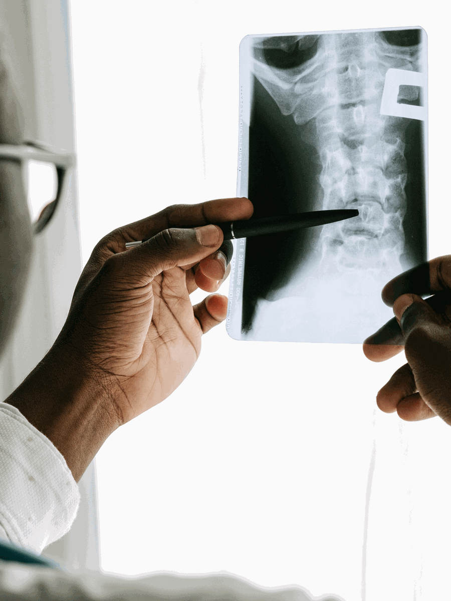 Sciatique ou cruralgie : comprendre les trajets nerveux