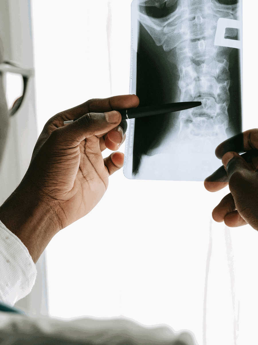 Shockwave for back pain: realistic indications, evidence and limitations