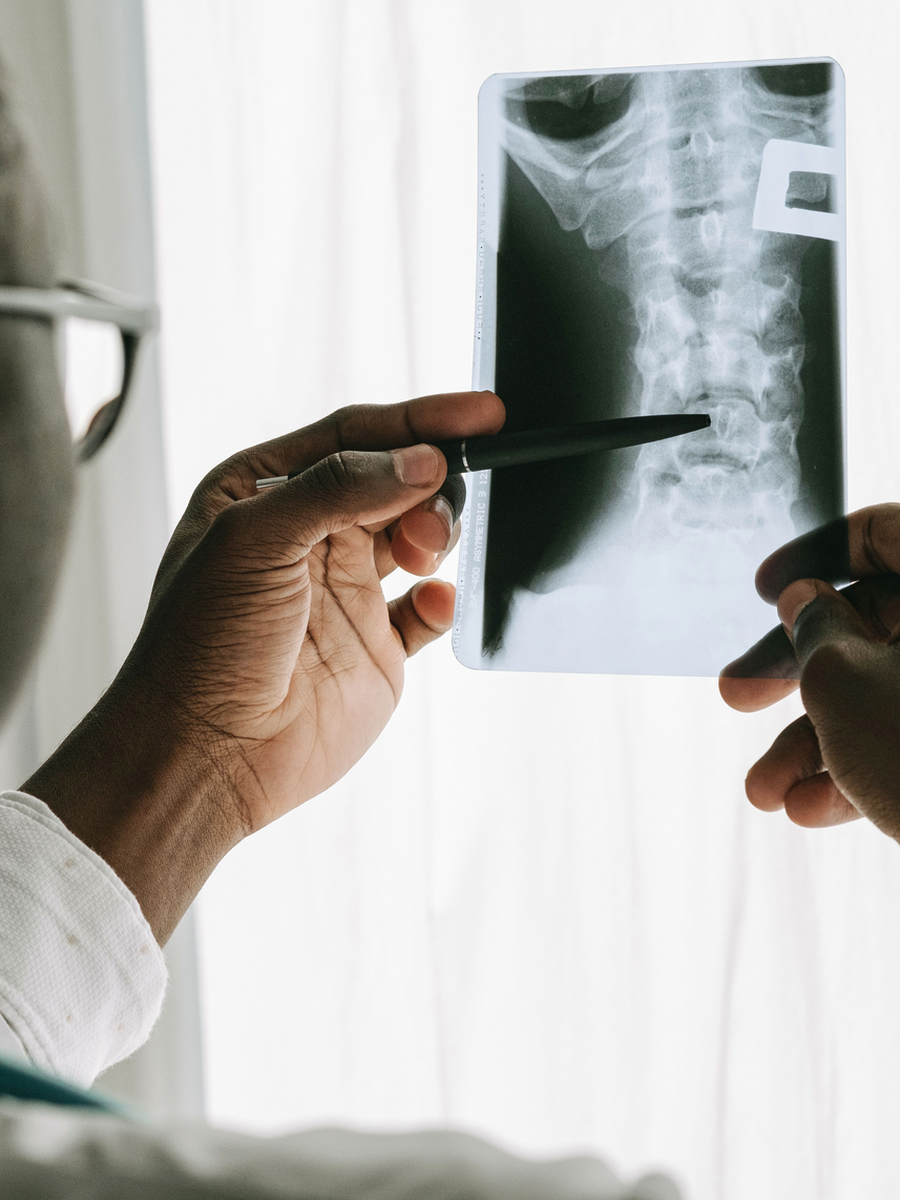 Spondylolisthesis: vertebral slip, symptoms, stability and treatment options