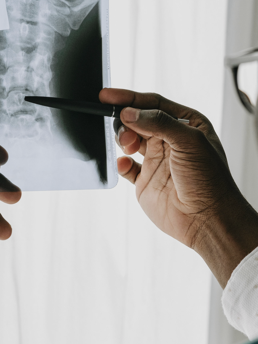 Vertebral compression fracture: sudden back pain, imaging and treatment