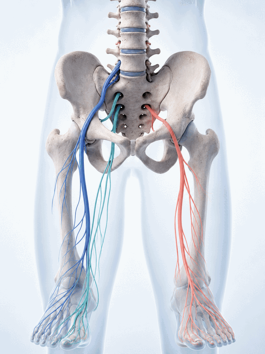 Disc space narrowing in Montreal: prognosis and recovery